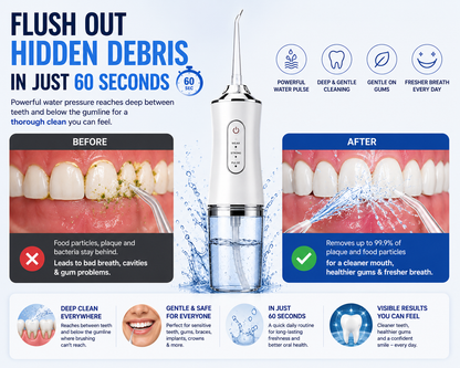 FreshJet™ Water Flosser