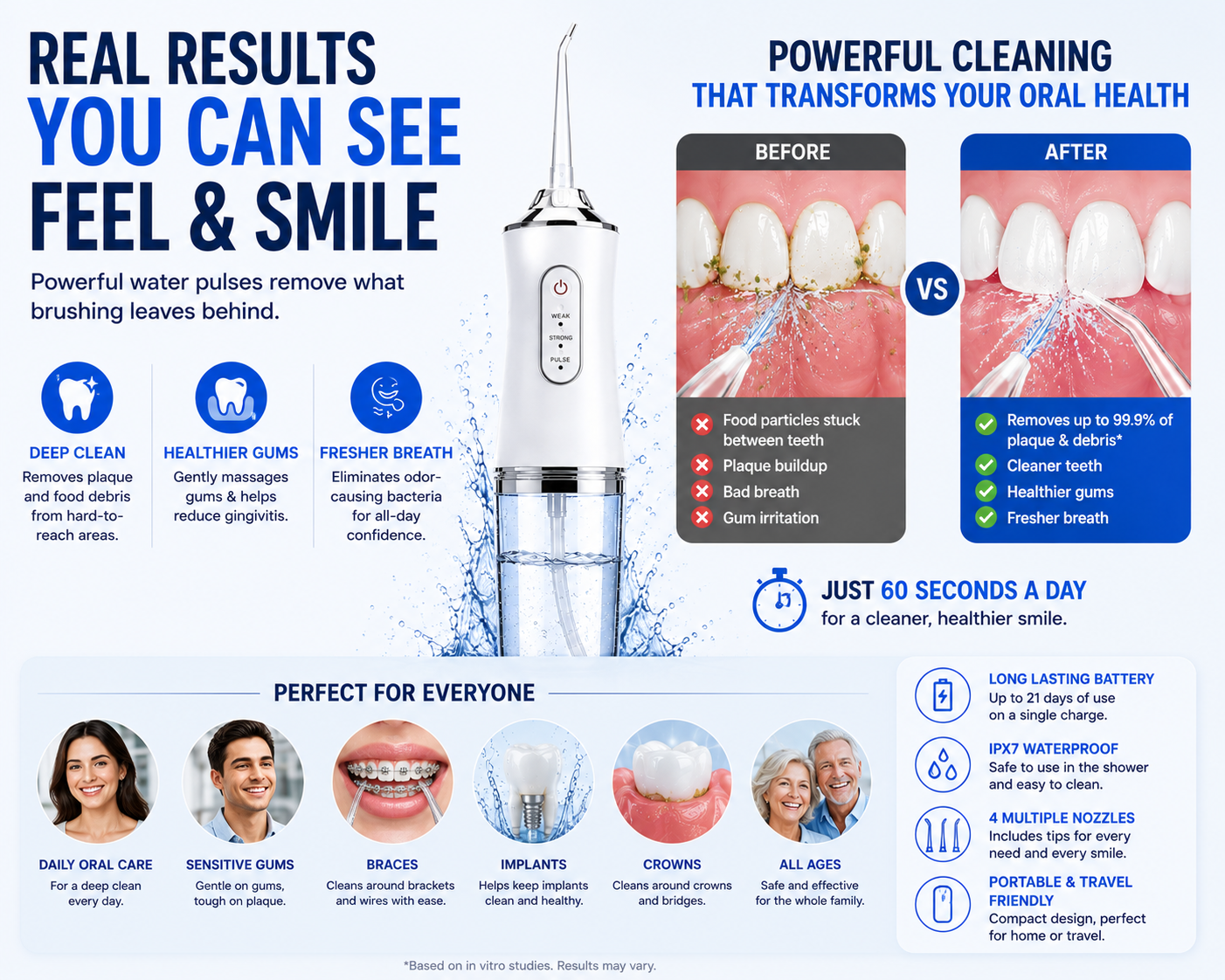 FreshJet™ Water Flosser